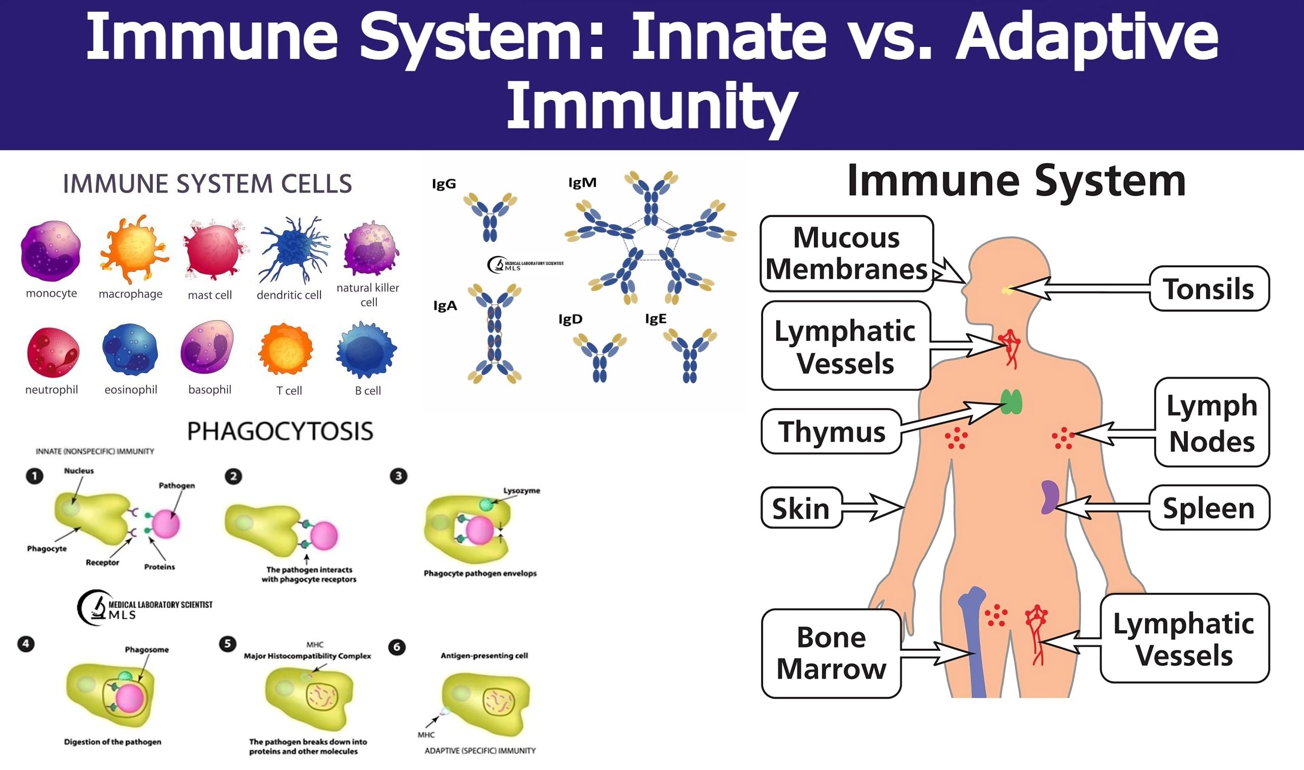 Innate Immunity Diagram Labeled