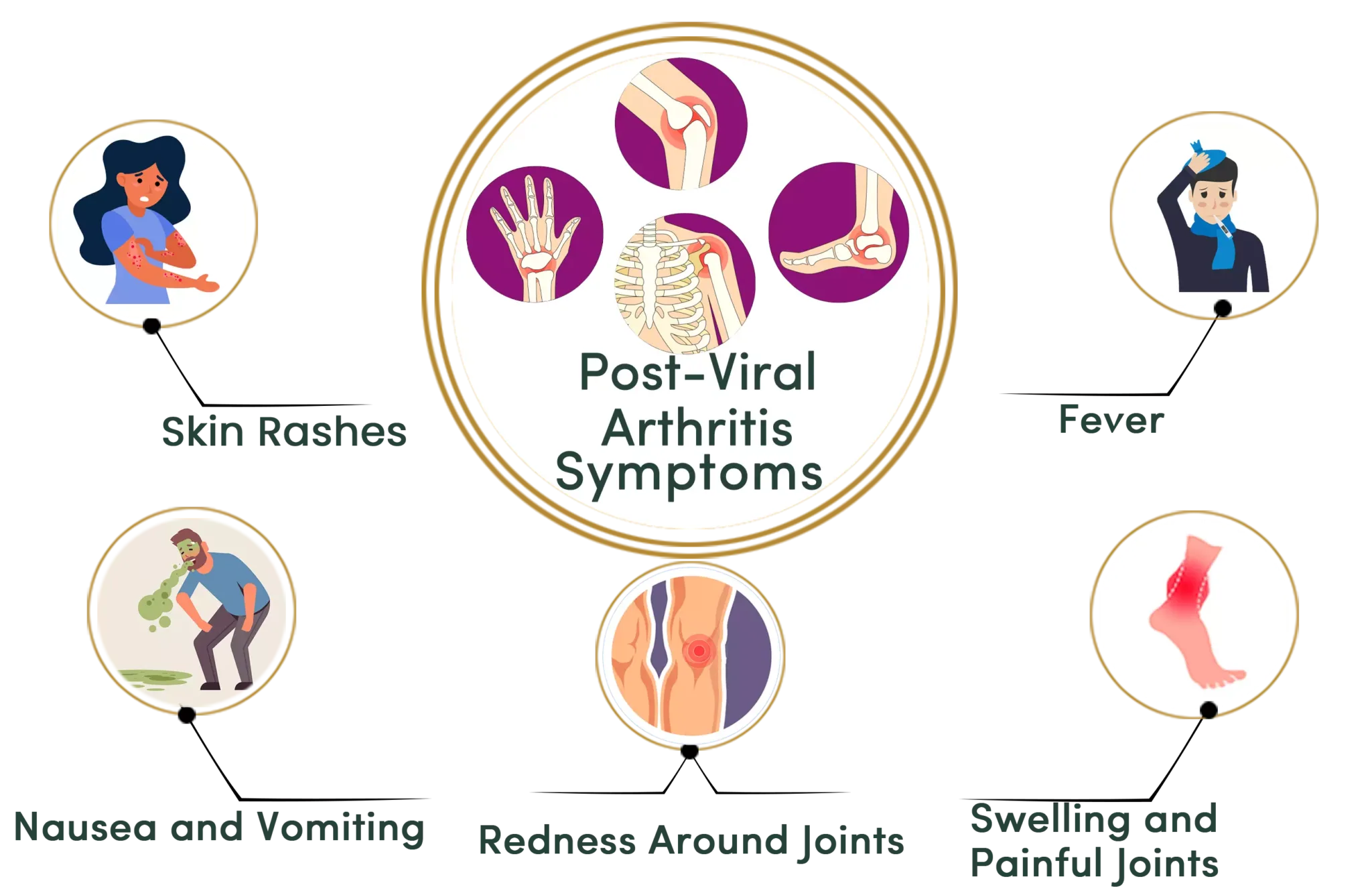 Post Viral Arthritis Treatment - Durja Ayurveda